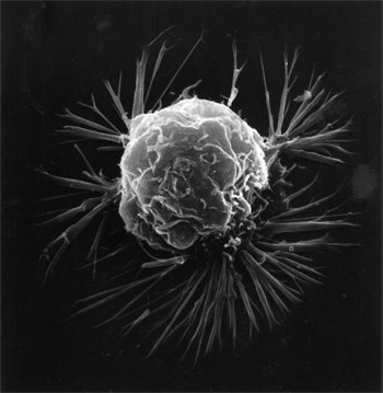 breast cancer cell